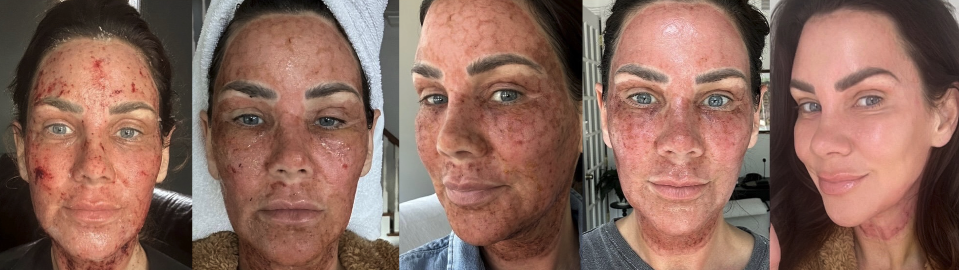 Heilungsverlauf Patientin 2