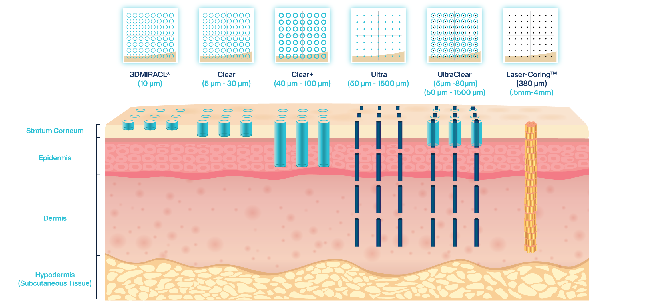 Hautschichten und Behandlungstiefen