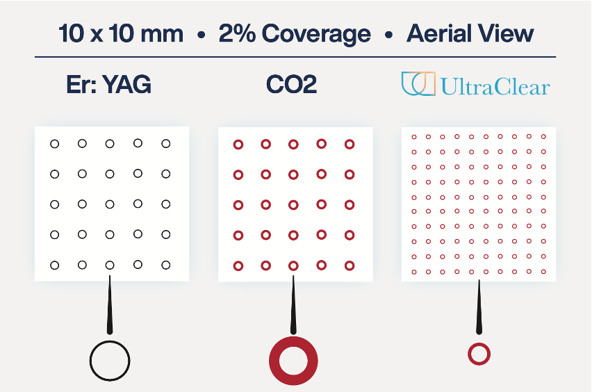 Aerial View — Er:YAG vs CO2 vs UltraClear