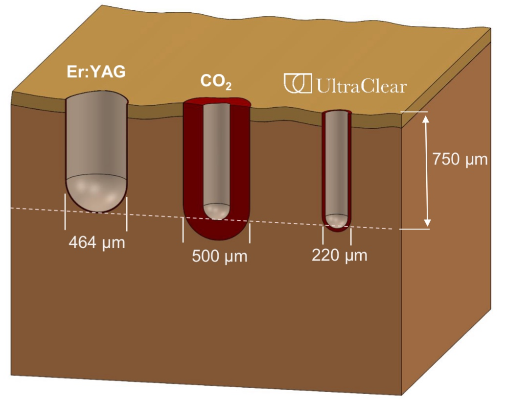 Mikrokanal Querschnitt
